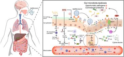 Microbiota and COVID-19: Long-term and complex influencing factors